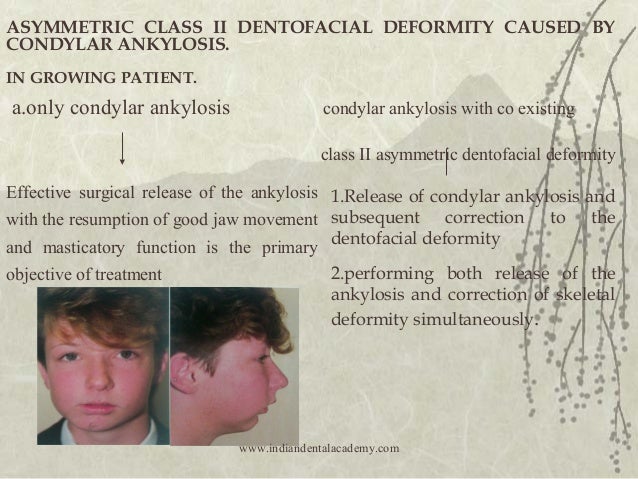 Congenital deformity semi facial micro s Floozie by frost french bikini